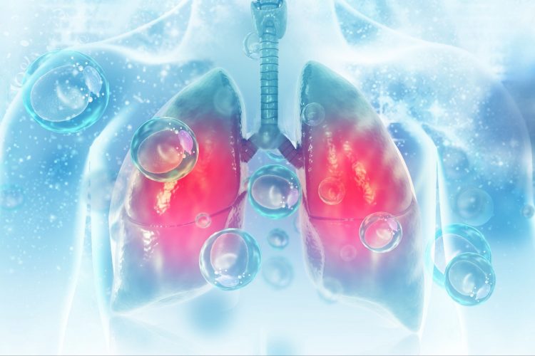 Νεότερες εξελίξεις στην αντιμετώπιση του μικροκυτταρικού καρκίνου του πνεύμονα