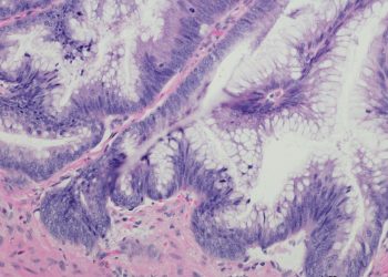 Επιτυχής Ολοκλήρωση της Διημερίδας για τις Γυναικολογικές Νεοπλασίες και Νεοπλασίες Ουροποιητικού και Μαστού