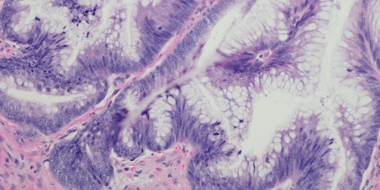 Επιτυχής Ολοκλήρωση της Διημερίδας για τις Γυναικολογικές Νεοπλασίες και Νεοπλασίες Ουροποιητικού και Μαστού