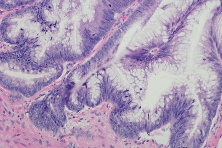 Επιτυχής Ολοκλήρωση της Διημερίδας για τις Γυναικολογικές Νεοπλασίες και Νεοπλασίες Ουροποιητικού και Μαστού