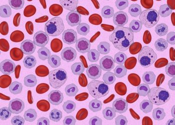 Ο Αμερικανικός Οργανισμός Φαρμάκων και Τροφίμων (FDA) εγκρίνει για πρώτη φορά θεραπεία για ασθενείς με ασυμπτωματικό πολλαπλούν μυέλωμα υψηλού κινδύνου για εξέλιξη σε συμπτωματική νόσο