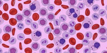 Ο Αμερικανικός Οργανισμός Φαρμάκων και Τροφίμων (FDA) εγκρίνει για πρώτη φορά θεραπεία για ασθενείς με ασυμπτωματικό πολλαπλούν μυέλωμα υψηλού κινδύνου για εξέλιξη σε συμπτωματική νόσο