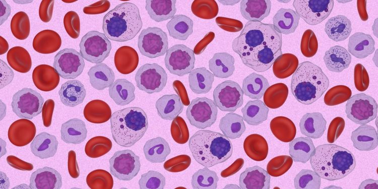 Ο Αμερικανικός Οργανισμός Φαρμάκων και Τροφίμων (FDA) εγκρίνει για πρώτη φορά θεραπεία για ασθενείς με ασυμπτωματικό πολλαπλούν μυέλωμα υψηλού κινδύνου για εξέλιξη σε συμπτωματική νόσο