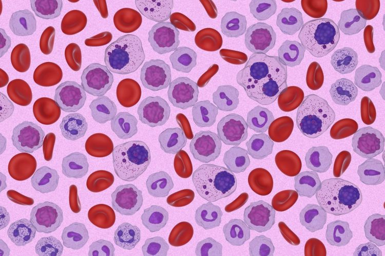 Ο Αμερικανικός Οργανισμός Φαρμάκων και Τροφίμων (FDA) εγκρίνει για πρώτη φορά θεραπεία για ασθενείς με ασυμπτωματικό πολλαπλούν μυέλωμα υψηλού κινδύνου για εξέλιξη σε συμπτωματική νόσο