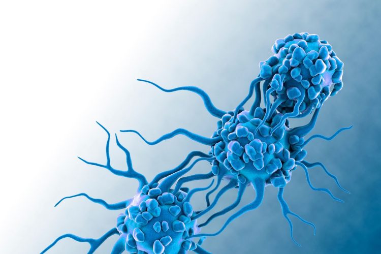 Καρκίνοι σε νεαρές ηλικίες: Ένα νέο σήμα κινδύνου