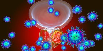 Νέα θεραπευτική αγωγή για τον καρκίνο του προστάτη