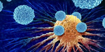 Σημαντικές εξελίξεις στην αντιμετώπιση του ουροθηλιακού καρκίνου στο ESMO 2025