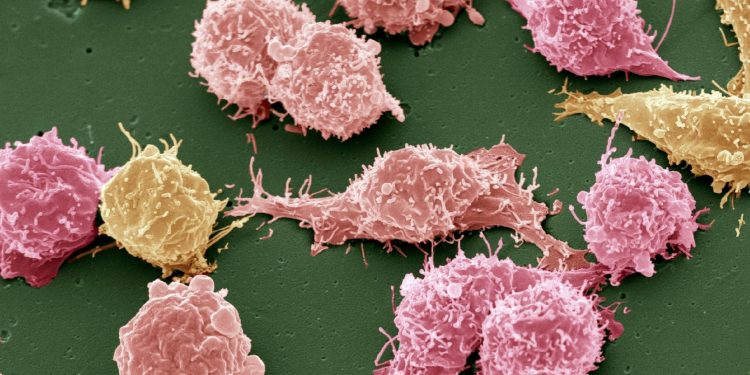 Ενημέρωση για θέματα Υγείας από τη Θεραπευτική Κλινική του Εθνικού και Καποδιστριακού Πανεπιστημίου Αθηνών