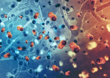 Η θεραπευτική κλινική του ΕΚΠΑ στην πρωτοπορία για το πολλαπλούν μυέλωμα και τις λοιπές πλασματοκυτταρικές δυσκρασίες