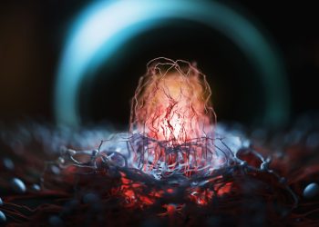 Νέα συστηματική θεραπεία για την αντιμετώπιση του καρκίνου του παγκρέατος