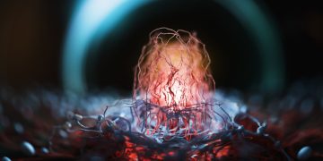 Νέα συστηματική θεραπεία για την αντιμετώπιση του καρκίνου του παγκρέατος