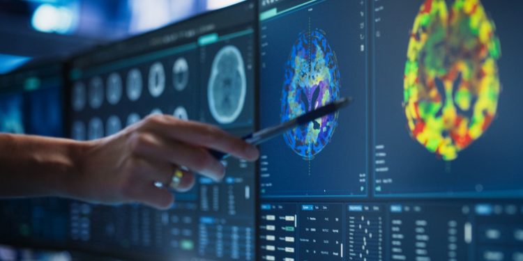 Νέα θεραπευτική επιλογή για τον μυοδιηθητικό καρκίνο της ουροδόχου κύστης