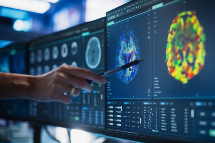 Νέα θεραπευτική επιλογή για τον μυοδιηθητικό καρκίνο της ουροδόχου κύστης