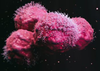 Νέος θεραπευτικός συνδυασμός για τον μετασταστικό ορμονοευαίσθητο καρκίνο του προστάτη