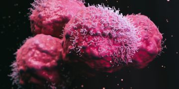 Νέος θεραπευτικός συνδυασμός για τον μετασταστικό ορμονοευαίσθητο καρκίνο του προστάτη