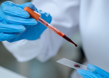 Αιματολογική – Ογκολογική Μονάδα της Θεραπευτικής Κλινικής ΕΚΠΑ (Νοσοκομείο Αλεξάνδρα): Δυναμική Παρουσία, Διεθνής Αναγνώριση και Αποτύπωμα Αριστείας το 2025