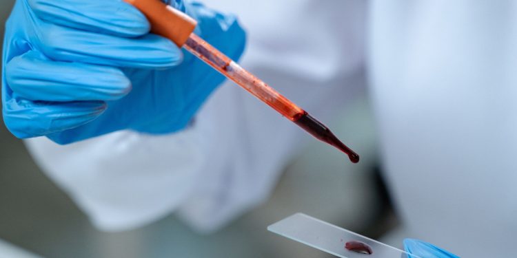 Αιματολογική – Ογκολογική Μονάδα της Θεραπευτικής Κλινικής ΕΚΠΑ (Νοσοκομείο Αλεξάνδρα): Δυναμική Παρουσία, Διεθνής Αναγνώριση και Αποτύπωμα Αριστείας το 2025