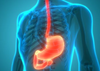 Η ανησυχητική αύξηση των γαστρεντερικών καρκίνων πρώιμης έναρξης: Τι γνωρίζουμε μέχρι σήμερα