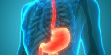 Η ανησυχητική αύξηση των γαστρεντερικών καρκίνων πρώιμης έναρξης: Τι γνωρίζουμε μέχρι σήμερα