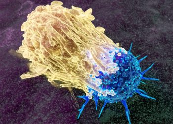 Παχυσαρκία και καρκίνος του ενδομητρίου: Τι αλλάζει σήμερα