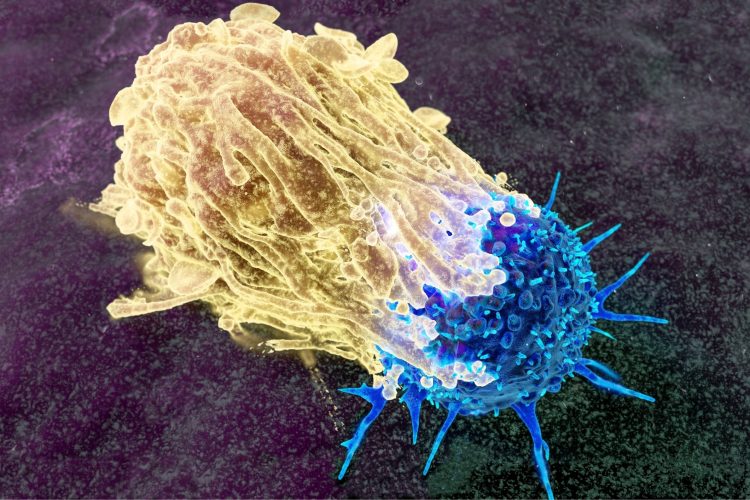 Παχυσαρκία και καρκίνος του ενδομητρίου: Τι αλλάζει σήμερα