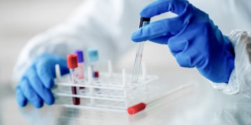 4ο Πανελλήνιο Συνέδριο και Παγκόσμια Ημέρα Σπάνιων Παθήσεων: Εξελίξεις στη διάγνωση και θεραπεία των σπάνιων αιματολογικών νεοπλασμάτων