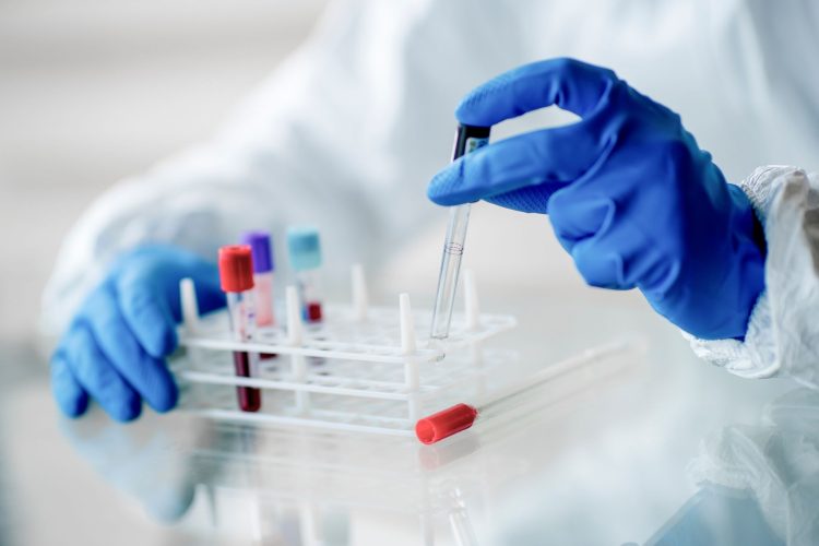 4ο Πανελλήνιο Συνέδριο και Παγκόσμια Ημέρα Σπάνιων Παθήσεων: Εξελίξεις στη διάγνωση και θεραπεία των σπάνιων αιματολογικών νεοπλασμάτων