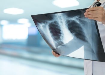 Εμβόλιο κατά του προχωρημένου καρκίνου του πνεύμονα