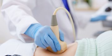 Ο ρόλος της προληπτικής αμφοτερόπλευρης σαλπιγγεκτομής στη μείωση της επίπτωσης του καρκίνου των ωοθηκών