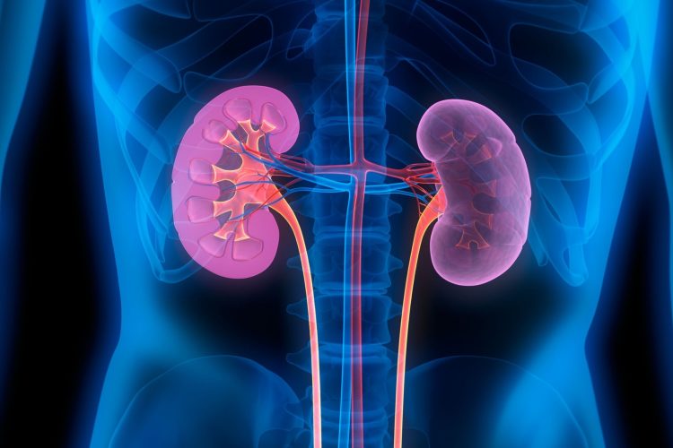 Νέα θεραπευτική αγωγή για την αντιμετώπιση του μεταστατικού καρκίνου του νεφρού