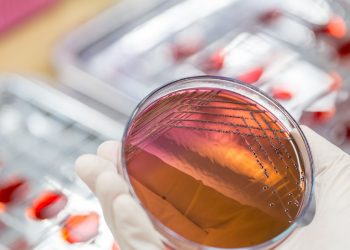 Υπερμικρόβια: Οι θάνατοι μπορεί να φτάσουν τα 8 εκατομμύρια έως το 2050