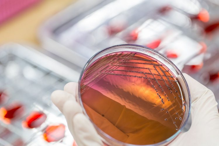 Υπερμικρόβια: Οι θάνατοι μπορεί να φτάσουν τα 8 εκατομμύρια έως το 2050