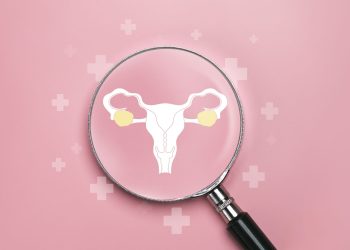 Νέα θεραπευτική αντιμετώπιση για τον καρκίνο των ωοθηκών