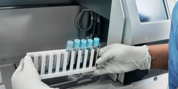 Εντυπωσιακά αποτελέσματα της Μελέτης Φάσης 3 SUCCESSOR-2