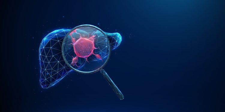 Νέα δεδομένα για το zenocutuzumab στο NRG1-θετικό χολαγγειοκαρκίνωμα