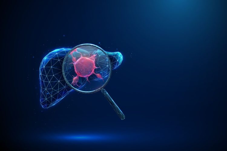 Νέα δεδομένα για το zenocutuzumab στο NRG1-θετικό χολαγγειοκαρκίνωμα