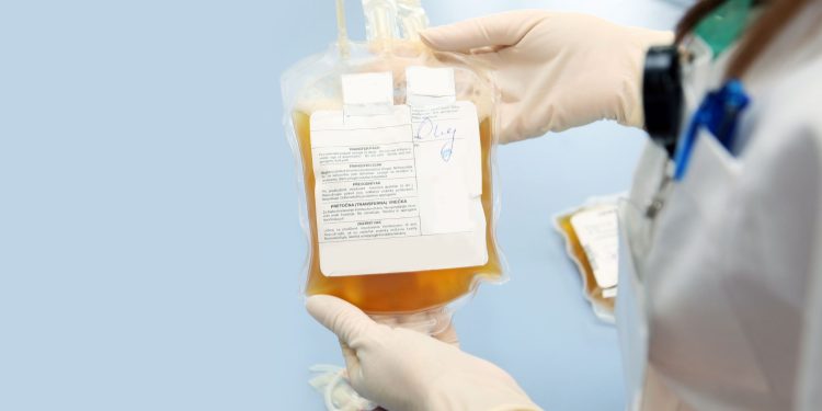 Θεραπευτική πλασμαφαίρεση στο ΠΓΝΑ «Αλεξάνδρα»