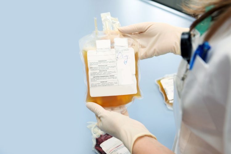 Θεραπευτική πλασμαφαίρεση στο ΠΓΝΑ «Αλεξάνδρα»