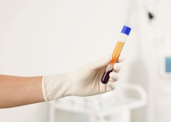 Τι δείχνουν τα διεθνή δεδομένα για τη θεραπευτική ανταλλαγή πλάσματος (πλασμαφαίρεση), γιατί είναι ασφαλής στα σωστά χέρια και γιατί δεν έχει καμία σχέση με τις «θεραπείες ευεξίας»