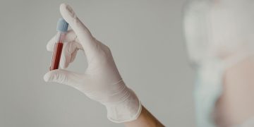 Μπορεί μια εξέταση αίματος να αλλάξει το μέλλον της έγκαιρης διάγνωσης του καρκίνου;