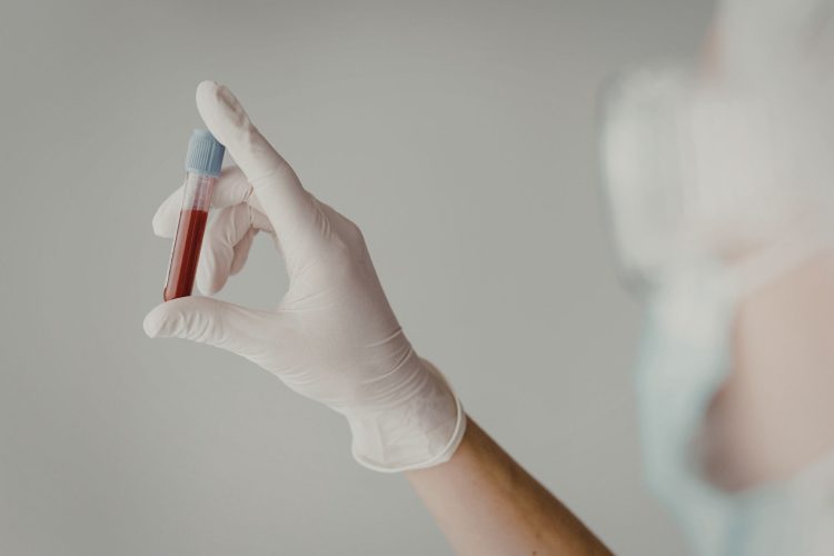 Μπορεί μια εξέταση αίματος να αλλάξει το μέλλον της έγκαιρης διάγνωσης του καρκίνου;